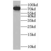 WB analysis of Jurkat cells, using NUDT6 antibody (1/500 dilution).