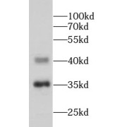 abx235925