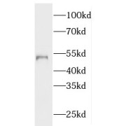 WB analysis of Jurkat cells, using NUSAP1 antibody (1/1500 dilution).