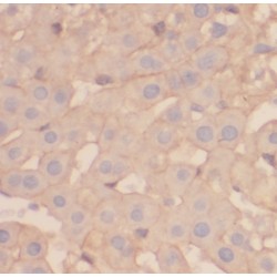 2'-5'-Oligoadenylate Synthetase 1 (OAS1) Antibody