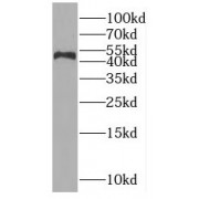 WB analysis of HeLa cells, using OAS1 antibody (1/500 dilution).