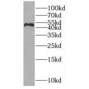 WB analysis of HeLa cells, using OAS1 antibody (1/500 dilution).