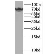 WB analysis of Jurkat cells, using OAS2 antibody (1/500 dilution).