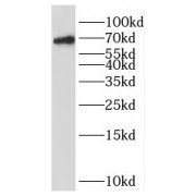 WB analysis of Jurkat cells, using OAS2 antibody (1/500 dilution).