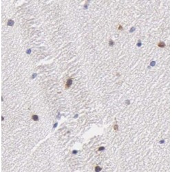 2'-5'-Oligoadenylate Synthetase 3 (OAS3) Antibody