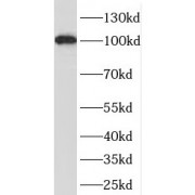 WB analysis of A375 cells, using OAS3 antibody (1/800 dilution).