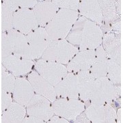 IHC-P analysis of human skeletal muscle tissue, using OBSCN antibody (1/50 dilution).