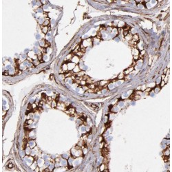 Outer Dense Fiber of Sperm Tails 1 (ODF1) Antibody