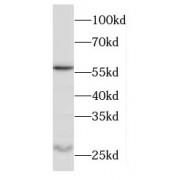WB analysis of rat testis tissue, using ODF1 antibody (1/600 dilution).