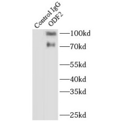 Outer Dense Fiber Protein 2 (ODF2) Antibody