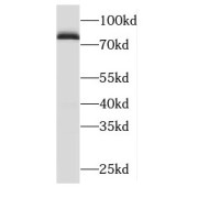 WB analysis of mouse testis tissue, using ODF2 antibody (1/500 dilution).