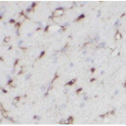 Teneurin Transmembrane Protein 1 (ODZ1) Antibody
