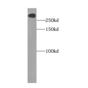 WB analysis of human brain tissue, using ODZ1 antibody (1/1500 dilution).