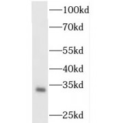 WB analysis of human skeletal muscle tissue, using OGFOD2 antibody (1/500 dilution).