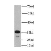 WB analysis of mouse skeletal muscle tissue, using OGG1 antibody (1/1000 dilution).