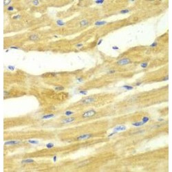 UDP-N-Acetylglucosamine--Peptide N-Acetylglucosaminyltransferase 110 kDa Subunit (OGT) Antibody