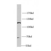 WB analysis of human brain tissue, using OGT antibody (1/1000 dilution).
