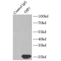 Opa Interacting Protein 5 (OIP5) Antibody