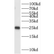 WB analysis of HEK-293 cells, using OIP5 antibody (1/2000 dilution).