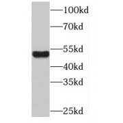 WB analysis of human brain tissue, using OLFM2 antibody (1/500 dilution).