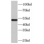 WB analysis of PC-3 cells, using OLFM3 antibody (1/1000 dilution).