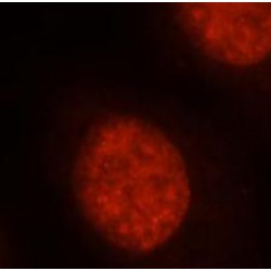 Oligodendrocyte Transcription Factor 2 (OLIG2) Antibody