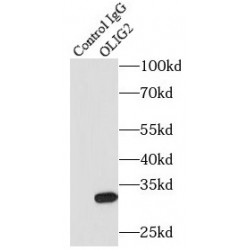 Oligodendrocyte Transcription Factor 2 (OLIG2) Antibody