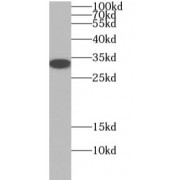WB analysis of human brain tissue, using OLIG2 antibody (1/600 dilution).