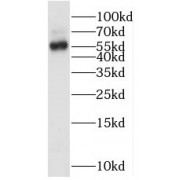 WB analysis of mouse liver tissue, using OMA1 antibody (1/500 dilution).