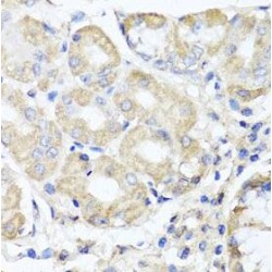 OPA3, Outer Mitochondrial Membrane Lipid Metabolism Regulator (OPA3) Antibody