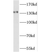 WB analysis of mouse brain tissue, using OPLAH antibody (1/300 dilution).