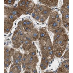 Orosomucoid 1 / 2 (ORM1/2) Antibody