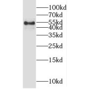 WB analysis of A549 cells, using OSBPL2 antibody (1/1000 dilution).