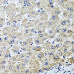 Probable tRNA N6-Adenosine Threonylcarbamoyltransferase, Mitochondrial (OSGEPL1) Antibody
