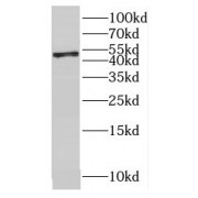 WB analysis of HeLa cells, using OVCA1 antibody (1/300 dilution).