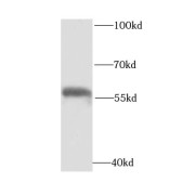 WB analysis of human brain tissue, using SCOT antibody (1/1000 dilution).