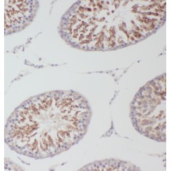 3-Oxoacid CoA-Transferase 2 (OXCT2) Antibody