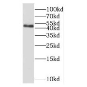 WB analysis of human heart tissue, using OXSM antibody (1/800 dilution).