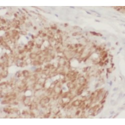 p120 Catenin Antibody