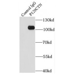 p120 Catenin Antibody