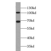 WB analysis of RAW264.7 cells, using p120 Catenin antibody (1/500 dilution).