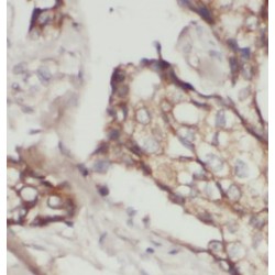 p120 Catenin Antibody