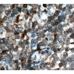 Cyclin-Dependent Kinase Inhibitor 2A / P16-INK4A Antibody