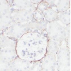 P2X Purinoceptor 7 (P2RX7) Antibody