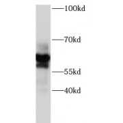 WB analysis of A375 cells, using P2RX7 antibody (1/1000 dilution).