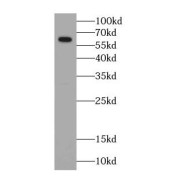 WB analysis of PC-3 cells, using P4HA1 antibody (1/1000 dilution).