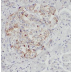 Prolyl 4-Hydroxylase Subunit Alpha-2 (P4HA2) Antibody