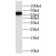 WB analysis of HeLa cells, using P4HA2 antibody (1/500 dilution).