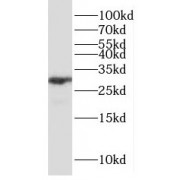 WB analysis of mouse kidney tissue, using P4HA3 antibody (1/300 dilution).