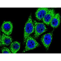 Sequestosome-1 (SQSTM1) Antibody